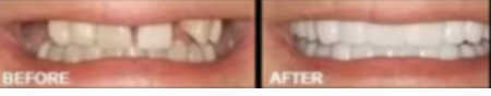 All On Four Dental Implants Long Island business image in Patchogue, NEW YORK